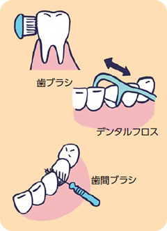 歯ブラシ／デンタルフロス／歯間ブラシ