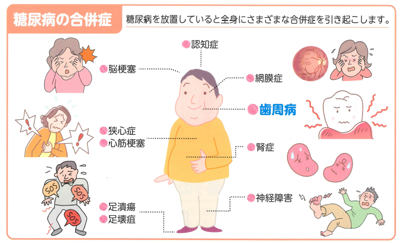 糖尿病の合併